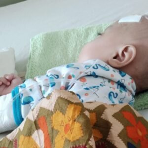 Antara Kenaikan Harta Bupati dan Penyakit Hydrocephalus Warga Karangpawitan Garut, Widya: Kenapa Pemerintah Seperti Tutup Mata