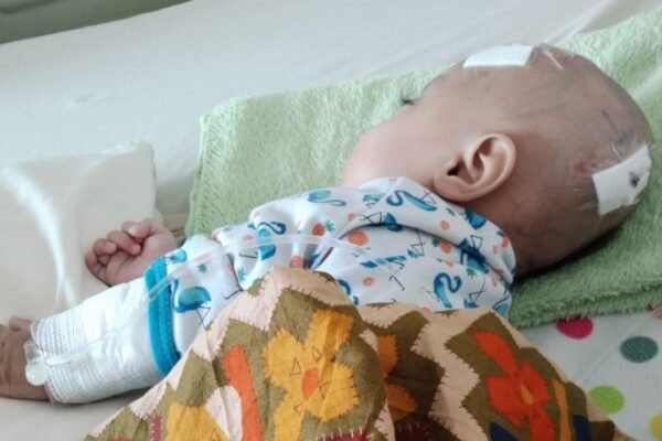 Antara Kenaikan Harta Bupati dan Penyakit Hydrocephalus Warga Karangpawitan Garut, Widya: Kenapa Pemerintah Seperti Tutup Mata