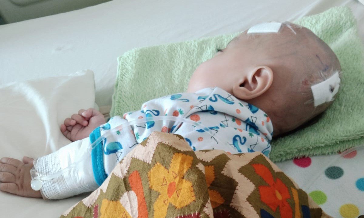 Antara Kenaikan Harta Bupati dan Penyakit Hydrocephalus Warga Karangpawitan Garut, Widya: Kenapa Pemerintah Seperti Tutup Mata