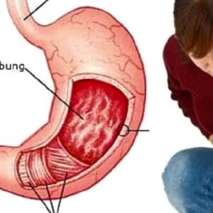 Dengan berbaring Asam lambung bisa reda