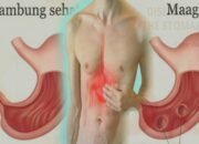 dr. Elisabeth: Penderita Asam Lambung Jangan Berbuka Dengan Teh Hangat