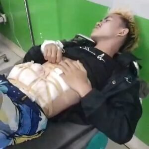 Geger… Tukang Sayur Ditikam OTK Saat Bongkar Muat di Pasar Kadungora Garut