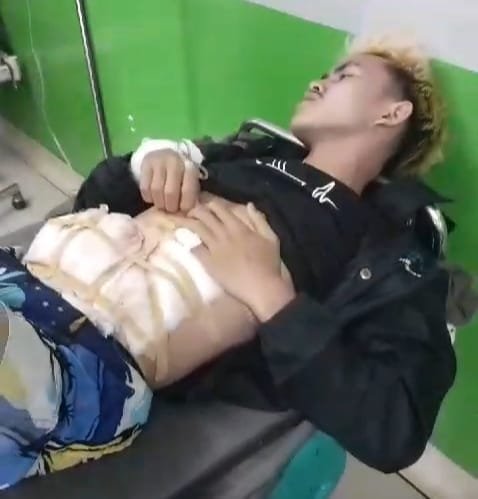 Geger… Tukang Sayur Ditikam OTK Saat Bongkar Muat di Pasar Kadungora Garut