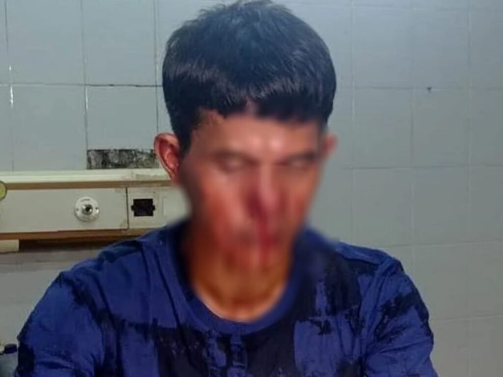 Seorang Jurnalis Babakbelur Dikeroyok Preman Saat Meliput Dugaan Pencemaran Lingkungan di Subang