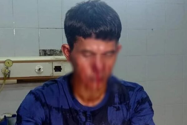 Seorang Jurnalis Babakbelur Dikeroyok Preman Saat Meliput Dugaan Pencemaran Lingkungan di Subang