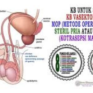 Ini Bahaya Vasektomi Untuk Pria Yang Diusulkan Gubernur Jabar Dalam Jangka Pendek Dan Jangka Panjang