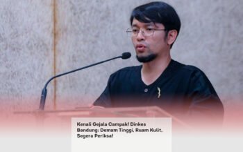 Kenali Gejala Campak Dinkes Bandung, Demam Tinggi, Ruam Kulit, Segera Periksa! locusonline featured image Apr